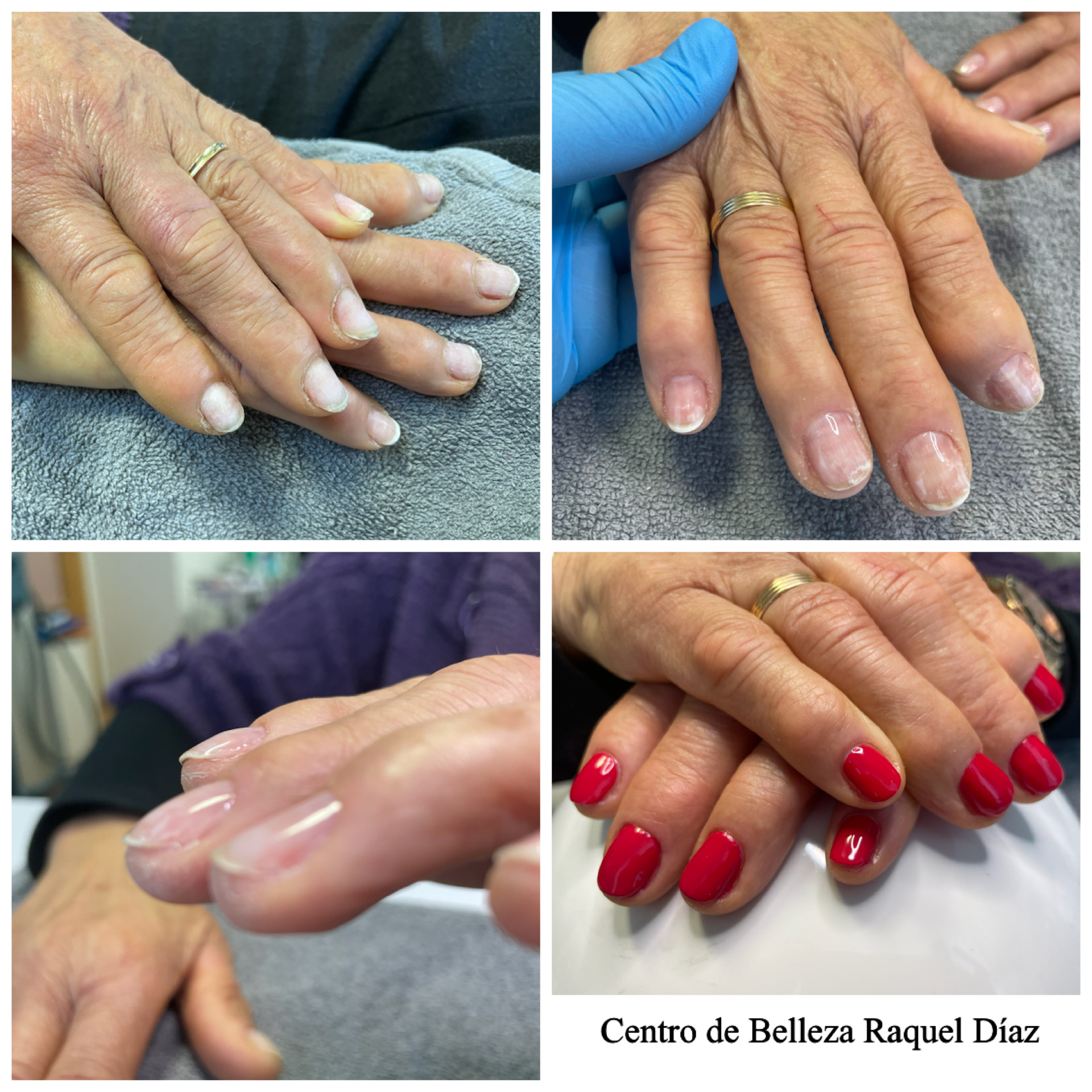 925d3753139d0fa7991ea481f886170b8da20208