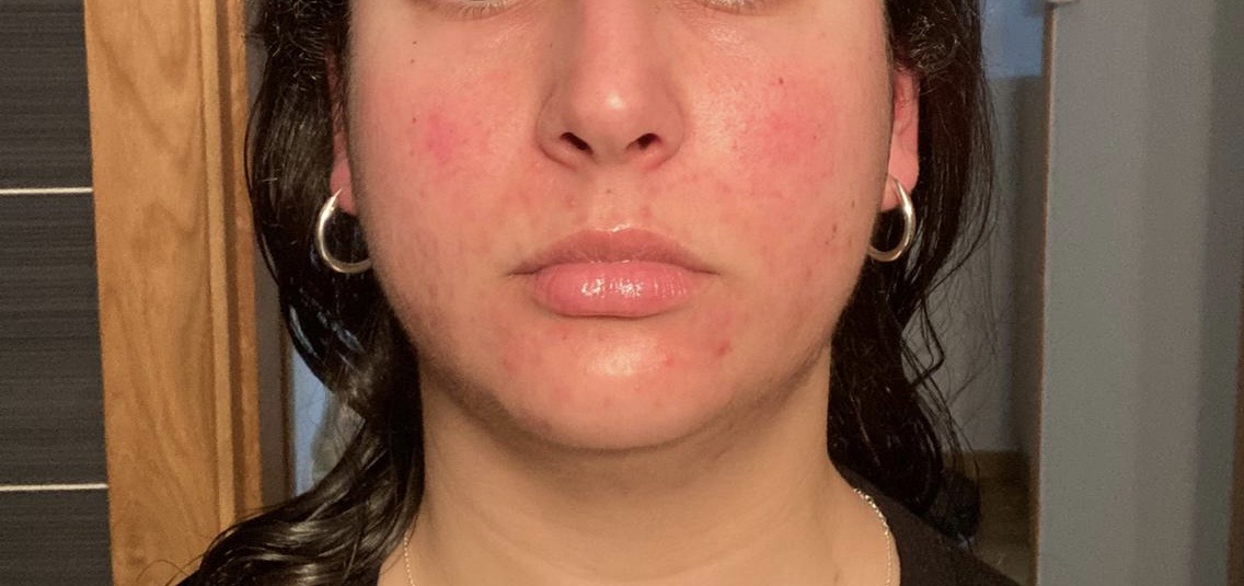 fc201b77 cf21 4fc1 9e3d 91c31d4c834e1